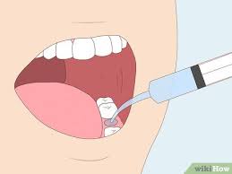 You'll likely need to continue the. 3 Ways To Relieve Dry Socket Wikihow Health
