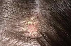 The benefits of oil mostly depend on its proper use. Grapeseed Oil For Hair Growth Natural Relaxed Hair Loss Benefits How To Use Best Brand Reviews Overnight
