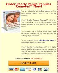 Maybe you would like to learn more about one of these? Pearlypenilepapulesremovalathome Posts Facebook