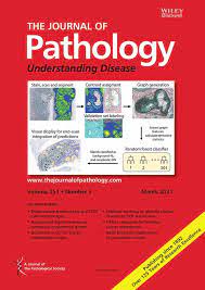 Register now to let malaysian journal of pathology know you want to review for them. The Journal Of Pathology Wiley Online Library