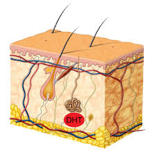Dht blockers are the most effective hair loss treatment. Hair Loss Treatment For Men Melbourne Hairlogica