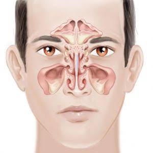 SINUSITIS SURGERY product image