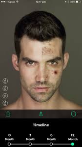 The Usefulness Of The ICE Effex Mobile App