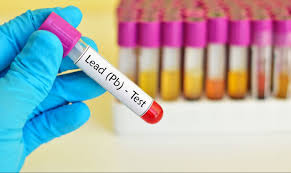 Image result for Lead Poisoning