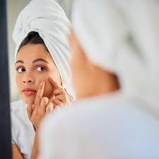 The Best Acne Spot Treatment To Get Rid Of A Pimple Fast Shape