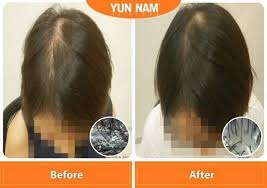 Our scalp shares the same piece of skin with our face so it deserves the same amount of care as well. 3 Nov 2020 Onward Yun Nam Hair Care Special Promo Everydayonsales Com