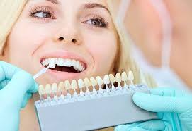 Porcelain Veneers Rochester Cosmetic Dentist Gentling