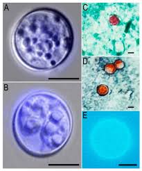 Image result for Cyclospora