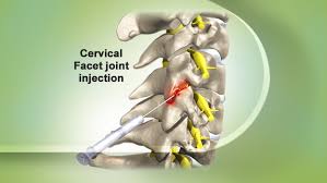 The facet joints that have the most range of motion are those in the neck area below the skull (cervical facet joints) and in the lower spine between the waist and hips (lumbar facet joints). Facet Joint Injection Indications And Complications Bone And Spine