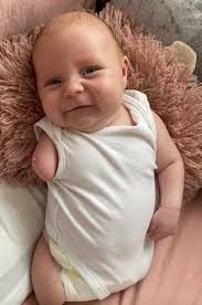 Tre was born with no arms and one leg