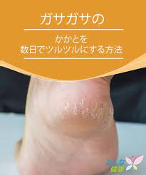 ガサガサのかかとを数日でツルツルにする方法 みんな健康 健康になる 健康 裏技ビューティー