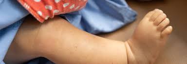 La femelă aparatul reproducător perioada incubatie oxiuri. Mieplo6j2rhorm