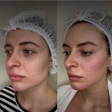 История торговой марки SachaJuan началась с создания в 1997 году в  Стокгольме сети салонов красоты. Основателями их стали парикмахеры-стилисты Sasha  Mitic и Juan Rosenlind, к тому времени уже зарекомендовавшие себя как  ведущие