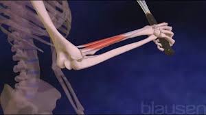 Medial epicondylitis is a type of tendinitis, a condition marked by inflammation or irritation of a tendon. Laterale Epicondylitis Verletzungen Und Vergiftung Msd Manual Ausgabe Fur Patienten