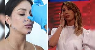 Sheyla Rojas evalúa revertir sus procedimientos estéticos: "Me había puesto  tanto ácido hialurónico"