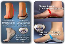 Custom Made Orthotics Http Www Kazmerfootandanklecenters Com Services Orthotics Ankle Strengthening Exercises Orthotics Human Body Science