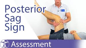 Image result for PCL Sag Test