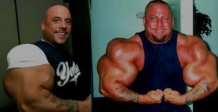 Image result for biggest biceps in world
