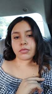 Antes y después de una extracción de tercer molar 🦷 #tercermolar  #muelasdeljuicio #endodoncia