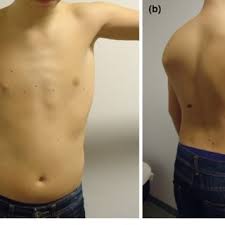 Underneath your ribs on the right hand side is your liver. Lump Near Left Rib Cage