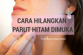 Maybe you would like to learn more about one of these? Testimoni Youth Shaklee Cara Hilangkan Parut Hitam Di Muka Its All About Nature N Passion