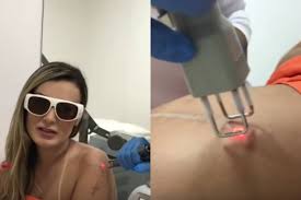 Andressa urach abre álbum de fotos de fim de semana em família. Andressa Urach Remove Tatuagens E Cicatriz No Bumbum Que Ficou Apos Retirar Hidrogel Quem Quem News