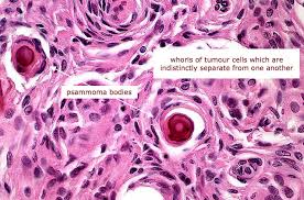Harold gray's work is in the howard gotlieb archival research center at boston university. Histopathology Flashcards Chegg Com