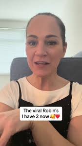 How to Get Robins to Feed from Your Hand