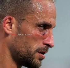 Leader ترفع له القبعة احتراماً وتقديراً. رغم الأصابة القوية اصر على  الاستمرار وقدم مباراه ممتازة