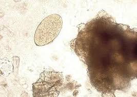 Il en existe des dizaines, mais les plus courants en france sont le ténia (ou ver solitaire) et les oxyures. Les Vers Parasites Chez L Homme Passionsante Be