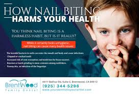 Routine Dental Exams Are Important For Nail Biters The Dentist Can Inspect For Any Damage And Recommend Measures Including The In 2020 Dental Exam Nail Biting Dentist