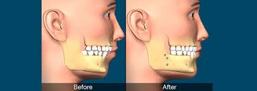 Pin On Dental Health