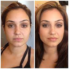 Antes e Depois Amanda
