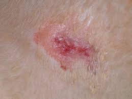 Abscesses In Dogs Symptoms And Treatment Pethelpful