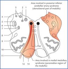 Bookbrain stem nuclei / 79 neuroscience sensory integration ideas neuroscience sensory integration sensory. Brainstem Textbook Of Clinical Neuroanatomy 2 Ed