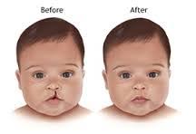 Sains teknologi dan kejuruteraan dalam islam (dua2012). Hukum Pembedahan Kosmetik Menurut Fiqh Islam Dan Perpektif Sains September 2016