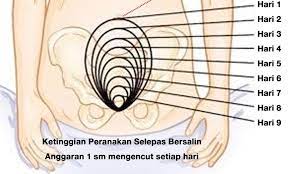 Buah pinggang bertugas menapis darah dan membuang bahan toksik, sisa buangan dan air berlebihan dari badan.kegagalan buah pinggang melakukan tugas penting ini boleh menyebabkan. Ubat Kecut Peranakan