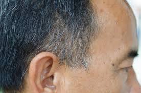 Some causes mean your greying hair can be salvageable, while others, not so much. Does Stress Cause Grey Hair Science Abc