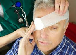 St. Louis Workmens Comp Benefits for Work Related Eye Injuries