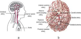 Check spelling or type a new query. 6 A Blood Is Supplied To The Entire Brain By Two Main Arteries The Download Scientific Diagram