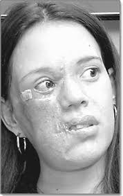 Surgeon, patient search for balance