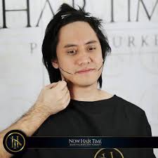 Ubah Penampilan, Ini 6 Potret Kevin Aprilio Jalani Transplantasi Rambut