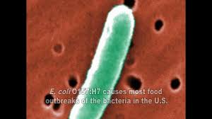 Coli are harmless or cause relatively brief diarrhea. E Coli Video Youtube