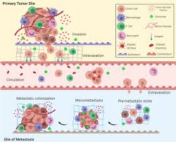 Whether it's the latest manoeuvring in global politics or the 'and finally' story that everyone's talking about, you'll be bang up to date with the news that counts. Molecular Principles Of Metastasis A Hallmark Of Cancer Revisited Signal Transduction And Targeted Therapy