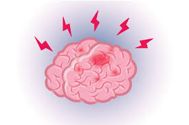You can use this swimming information to make your own swimming trivia questions. Brain Facts That Will Blow Your Mind The Healthy
