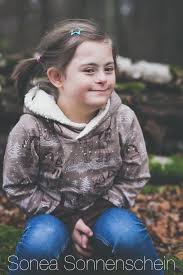 Down syndrome is also referred to as trisomy 21. Warum Sehen Menschen Mit Down Syndrom Alle Gleich Aus