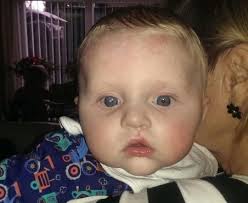 Michelle Turner warns of Retinoblastoma warning signs after Bromsgrove's Ethan  Warman's eye cancer ordeal