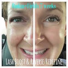 Dora Bolin's Instagram, Twitter & Facebook