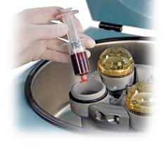 How can makevisas help you? Arthrex Platelet Rich Plasma