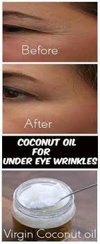 How To Use Coconut Oil For Under Eye Wrinkles Undereyewrinkles Under Eye Wrinkles Coconut Oil For Skin Eye Wrinkle